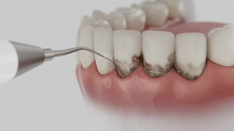 Reliable Dental Implants contractor in Tuckerton, NJ by Smile Center Dentistry